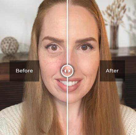 Eye Wrinkle Eraser